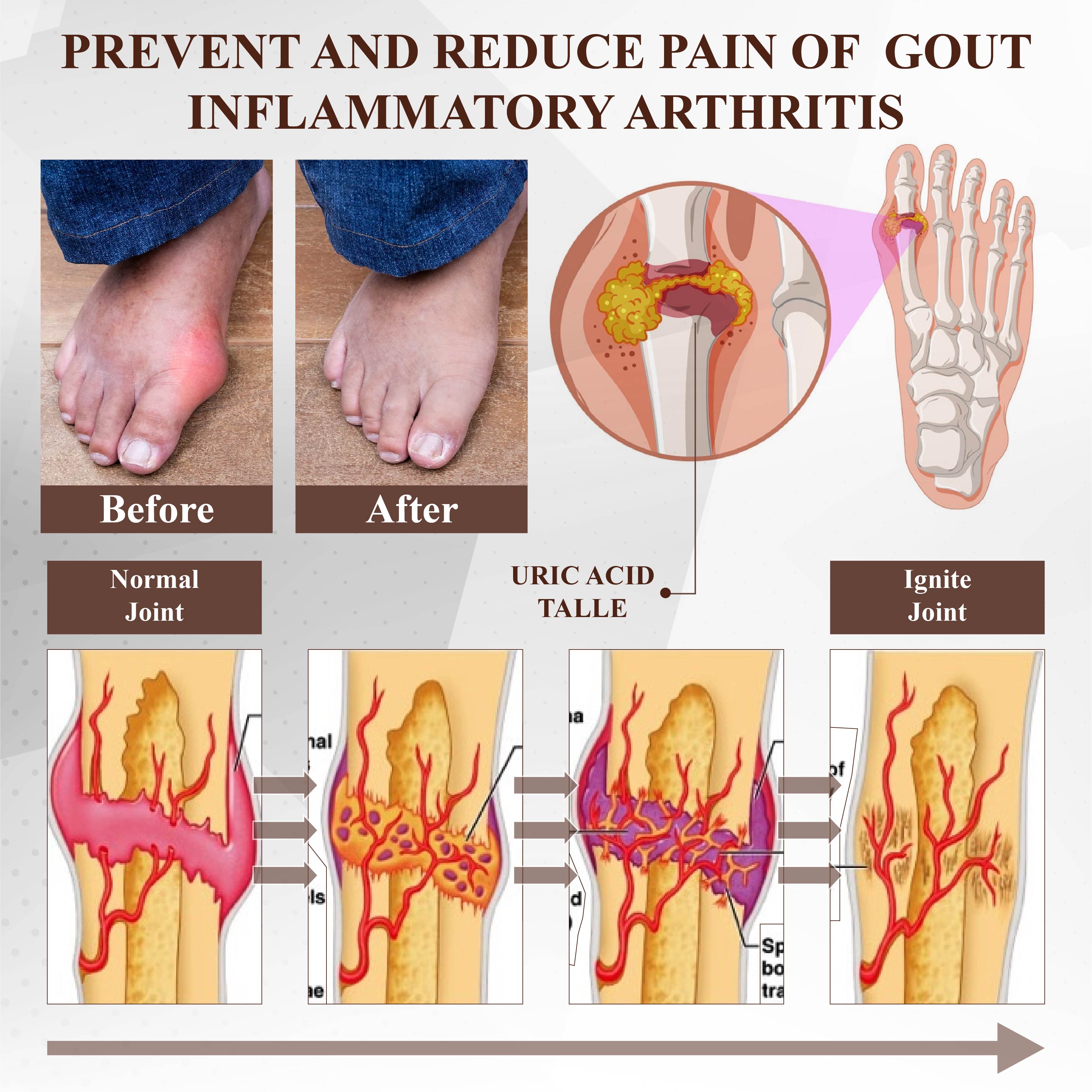 NeutralCare™ Emu Oil Turmeric Bone Sooth Gel