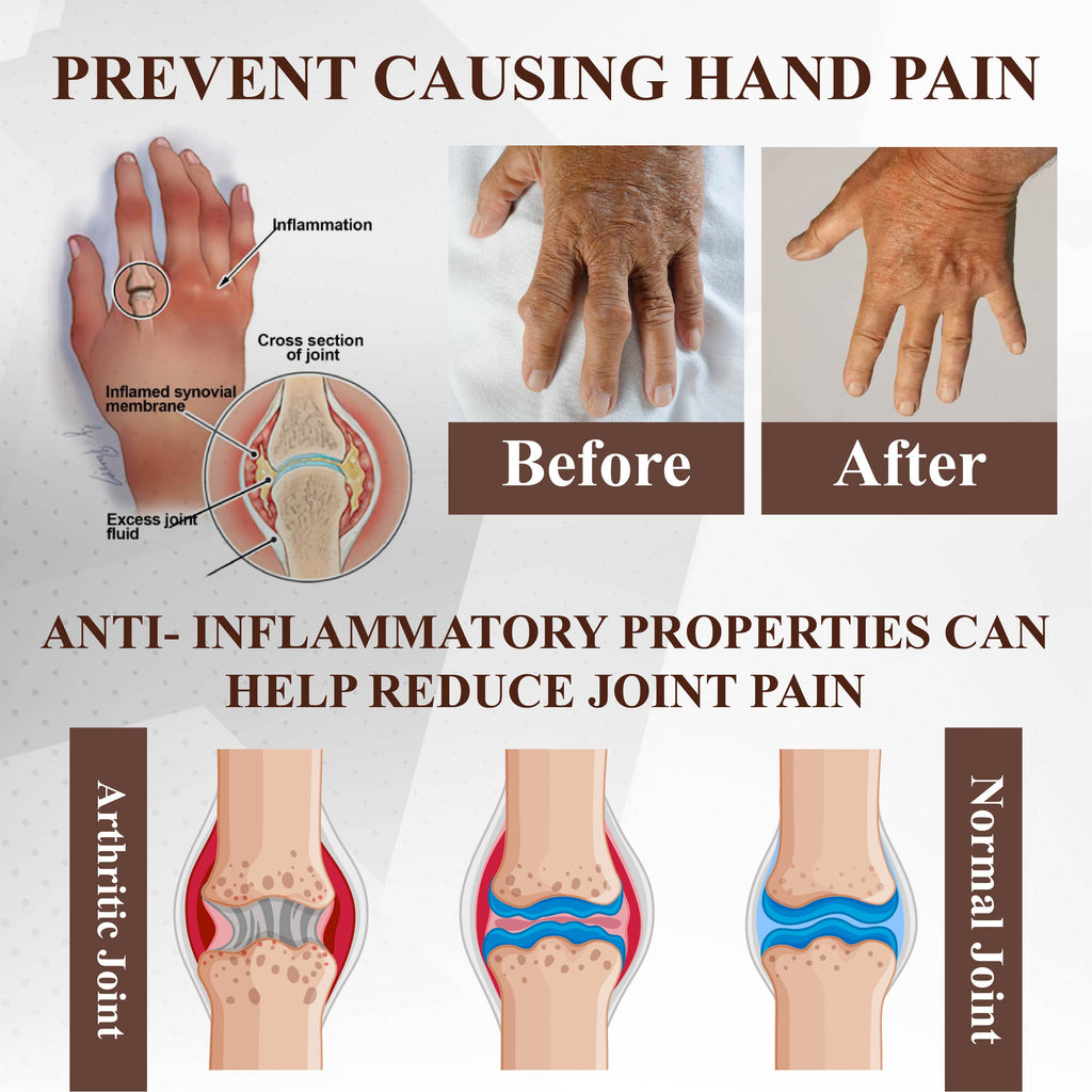 NeutralCare™ Emu Oil Turmeric Bone Sooth Gel