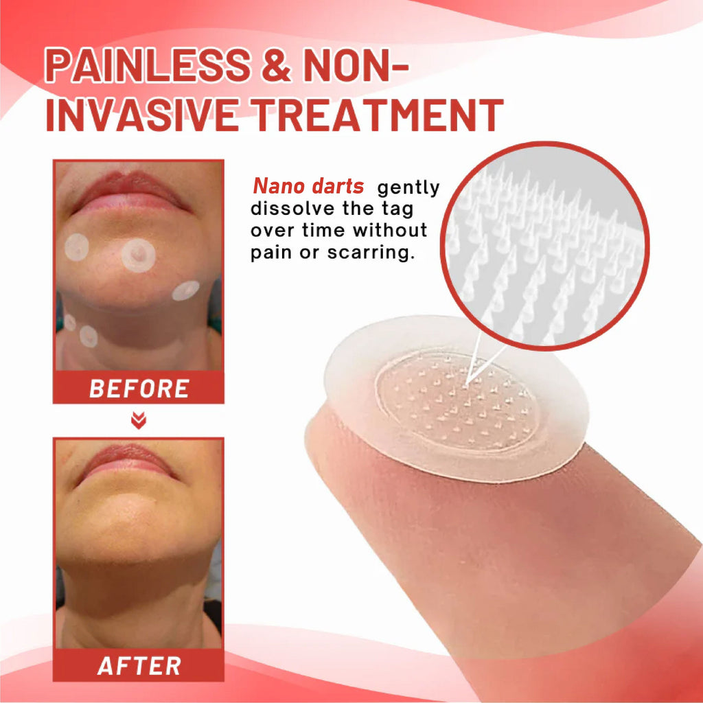 NeutralCare™ NanoDart Skin Tag Removal Patches