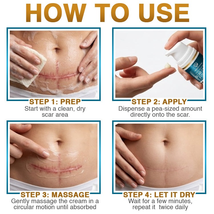 NeutralCare™ 100% Silicone Scar Cream Formula