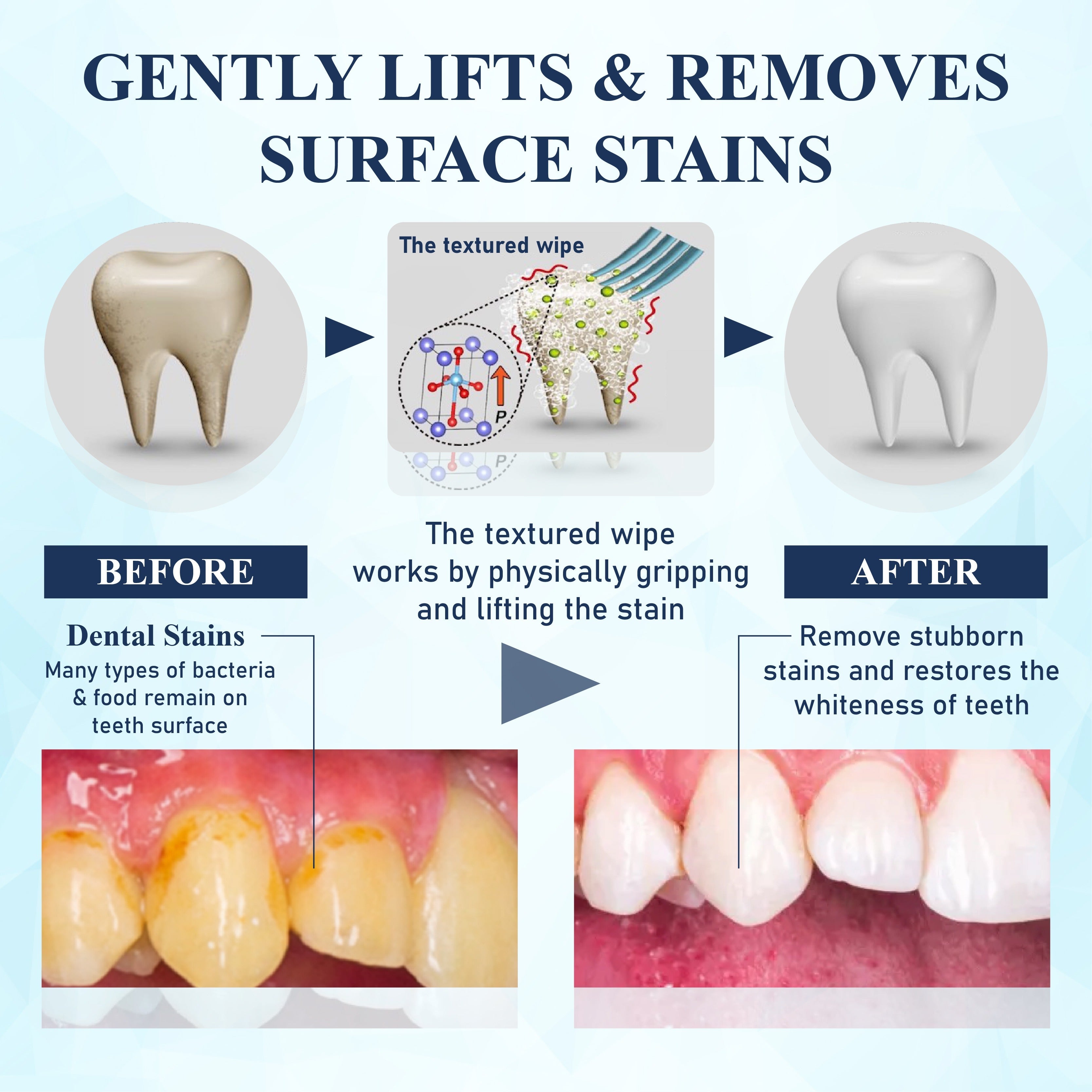 NeutralCare™ BrighteWipe Teeth Cleaning Finger Wipes