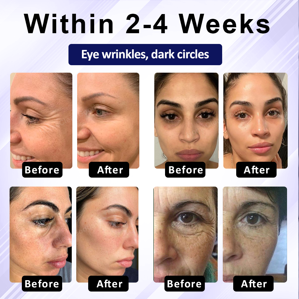 NeutralCare™ RadiantPro Retinol Eye Cream Stick