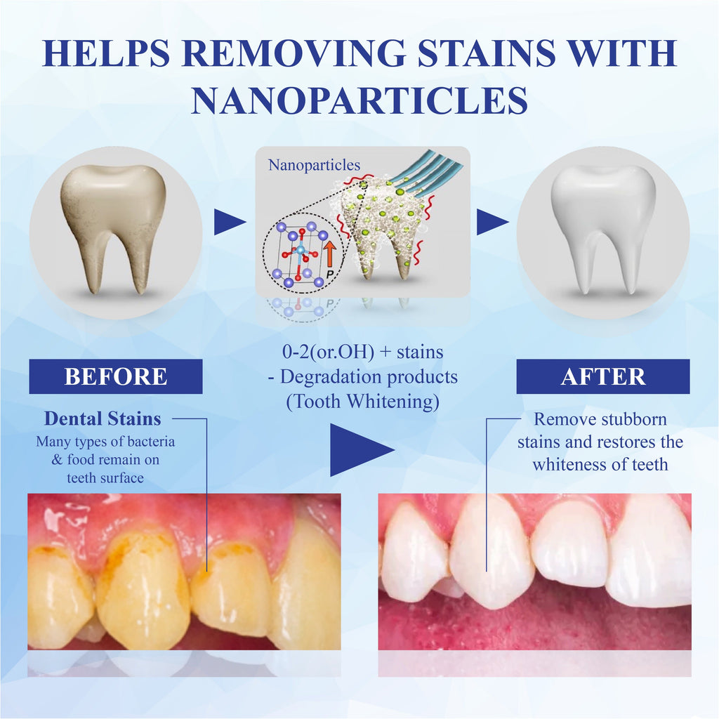 NeutralCare™ SmilePolish Nano Teeth Stain Cleaner