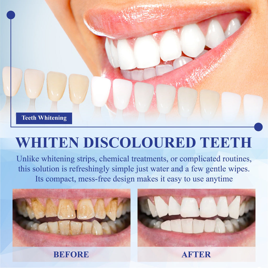 NeutralCare™ SmilePolish Nano Teeth Stain Cleaner
