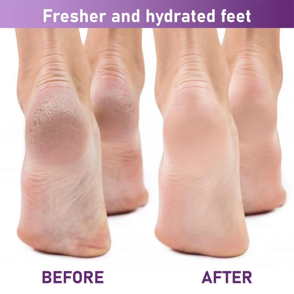 NeutralCare™ SmoothStep Exfoliating Foot Peel Mask Sock