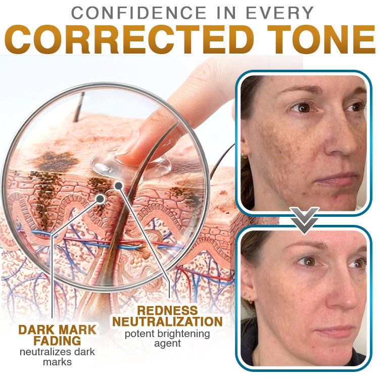 NeutralCare™ 100% Silicone Scar Cream Formula