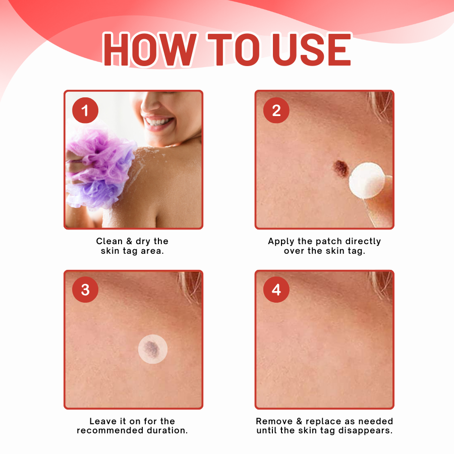 NeutralCare™ NanoDart Skin Tag Removal Patches